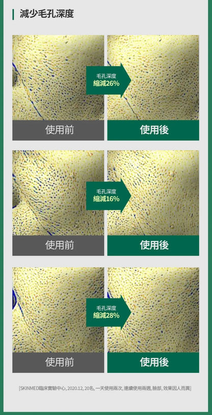 韓國熱賣｜綠番茄緊緻毛孔精華｜1盒2枝